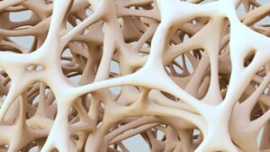 New Breakthrough to Strengthen Bones Could Reverse Osteoporosis