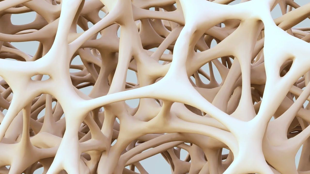 New Breakthrough to Strengthen Bones Could Reverse Osteoporosis