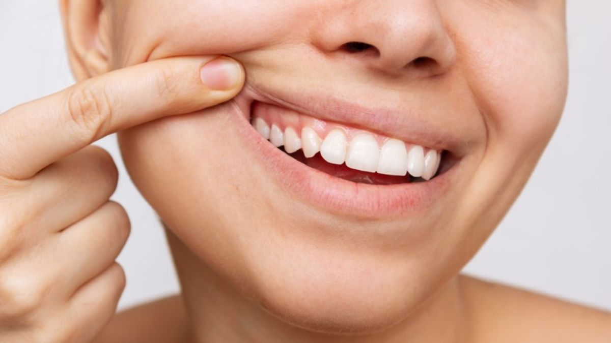Oral Health